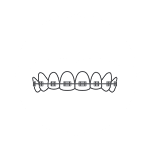 I Want A Straighter Smile