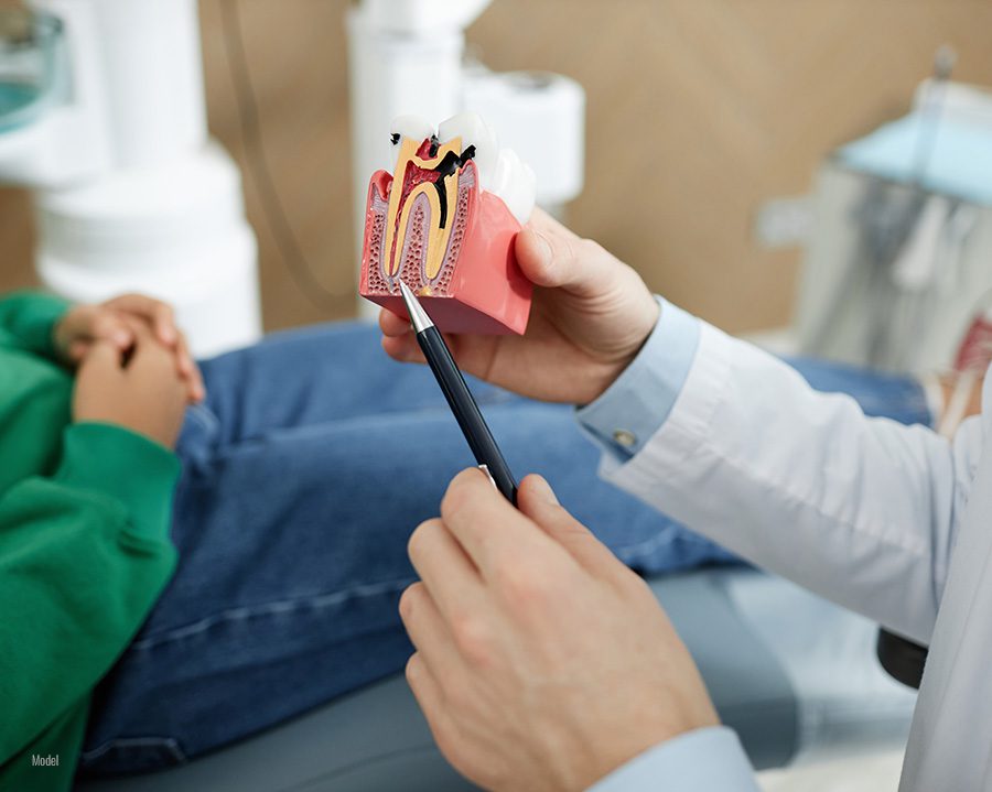 root canal therapy Schaumburg