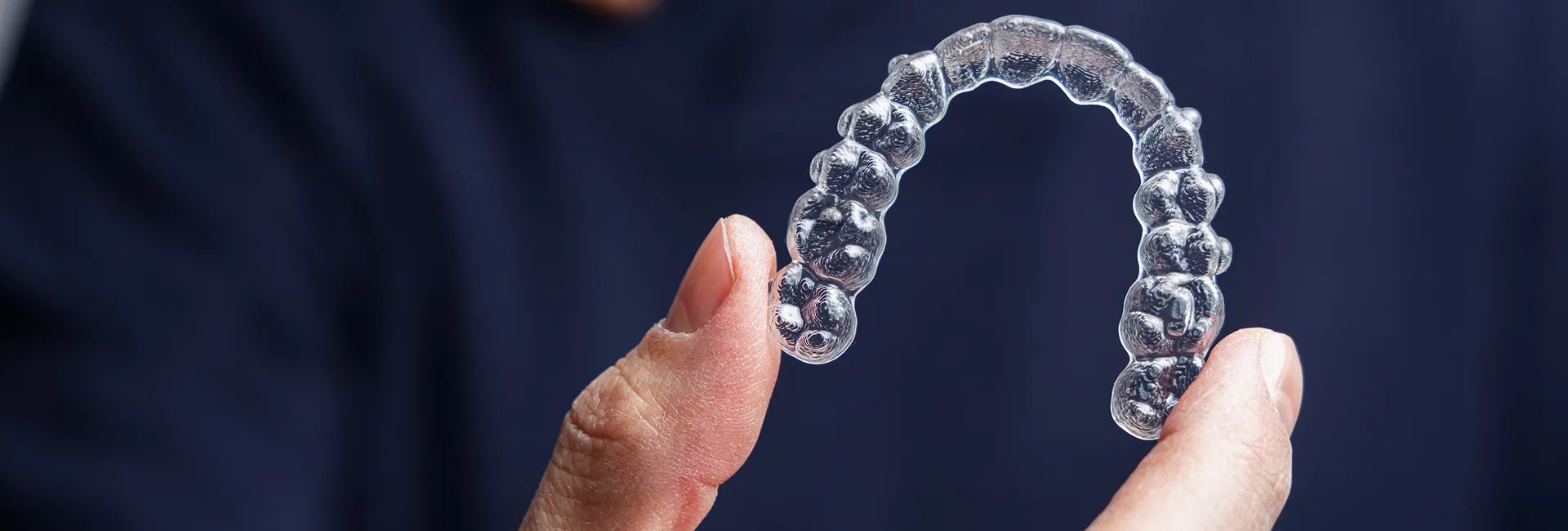 The Step-by-Step Invisalign Treatment Process at Royal Dental Care Schaumburg