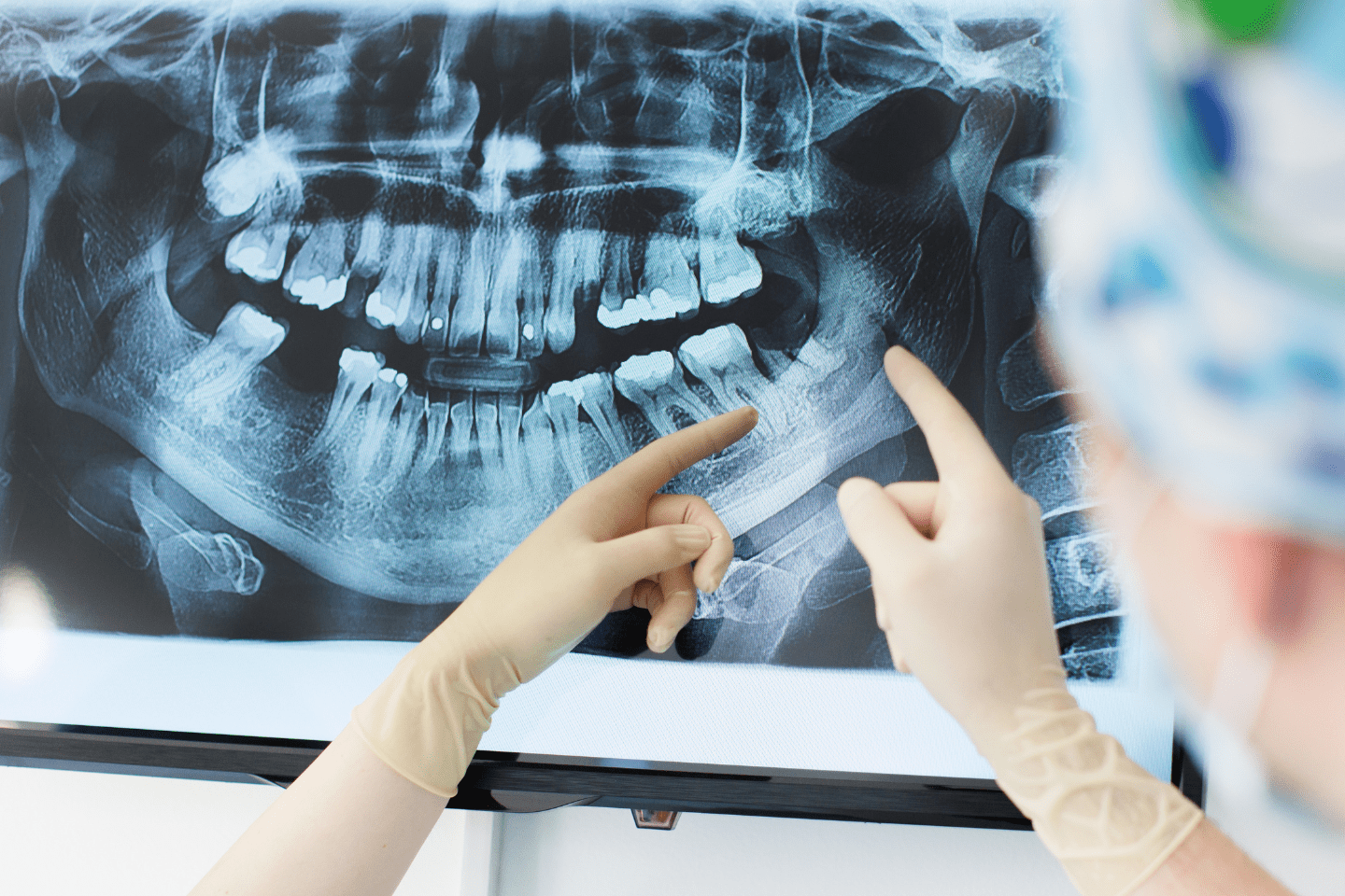 digital X-ray imaging